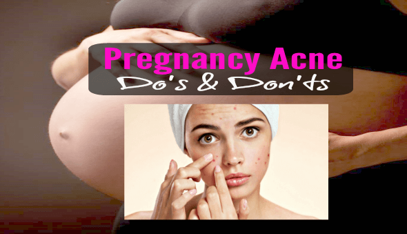 Pregnancy Acne - Do's & Don'ts