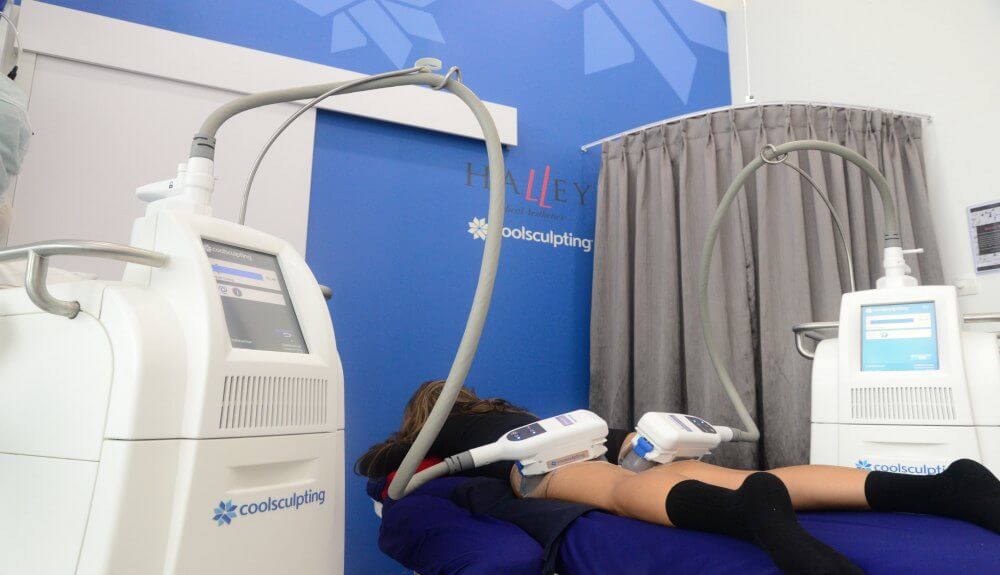 My “CoolSculpting” Review – Does it Really Work on Fat Thighs?